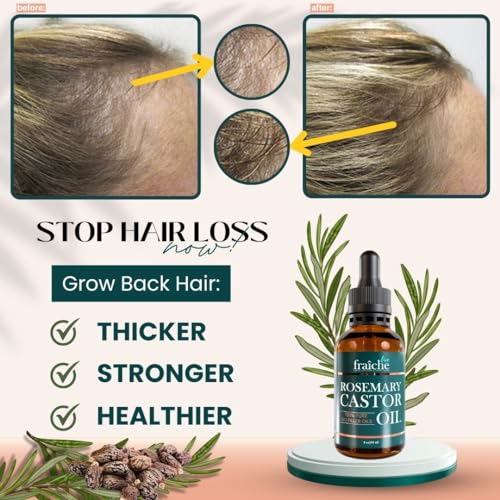 Rosemary Oil for Hair Growth (2oz) with Cold Pressed Castor Oil Y734